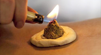 【艾灸知識(shí)】十大常見艾灸不良反應(yīng)，及處理方法！建議收藏！